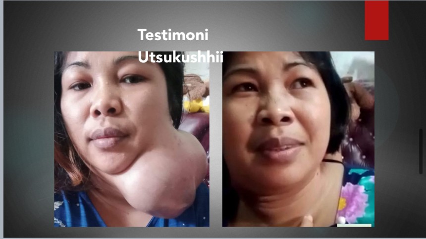 Testimoni Utsukushhii